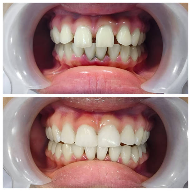 TMJ/TMD Treatment in June Park, FL